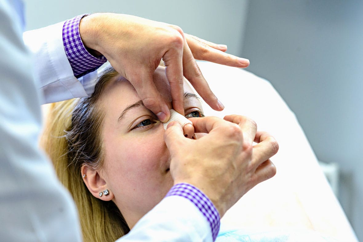 woman after getting an open rhinoplasty in NYC