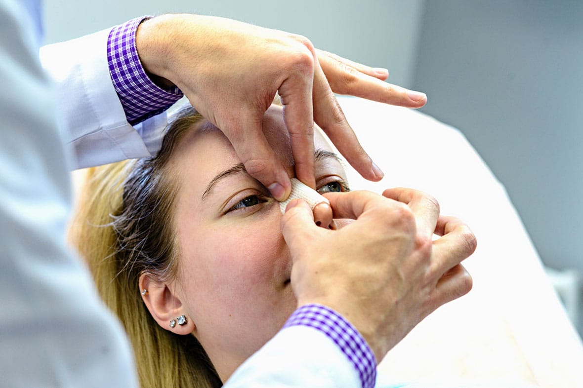 woman getting a rhinoplasty after a nose injury in NYC